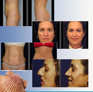 Cosmetic Procedures Brick NJ